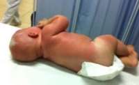 Paraná - Bebê de 5 meses é esquecido no Sol