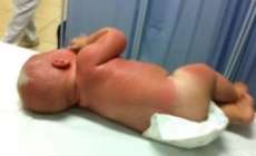 Paran&aacute; - Beb&ecirc; de 5 meses &eacute; esquecido no Sol