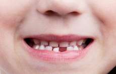 Antibi&oacute;tico enfraquece os dentes? Profissional responde