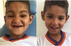 Menino chora ao realizar sonho de ter dentes "igual aos colegas"