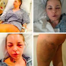 Atriz porn&ocirc; acusa lutador de MMA de agress&atilde;o: 'tive 18 ossos quebrados'