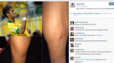 Felip&atilde;o rejeita "deboche" e diz que Neymar se irrita por apanhar muito