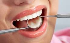 Entenda quando extrair os dentes do siso