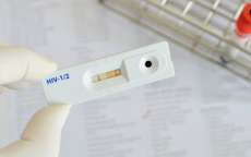 Novos casos infec&ccedil;&otilde;es por HIV em adultos voltam a aumentar em algumas regi&otilde;es do mundo