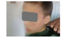Professora raspa cabelo da filha ap&oacute;s encontr&aacute;-la alcoolizada e acaba presa