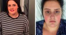Mulher quase morre ap&oacute;s esquecer o absorvente interno; entenda o caso