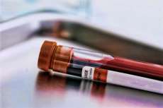 Exame de sangue pode indicar propens&atilde;o ao suic&iacute;dio