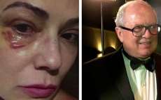 Ex de Luiza Brunet diz ter sofrido v&aacute;rias agress&otilde;es da atriz