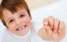 Arrancar os dentes de leite pode ser perigoso?