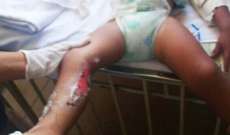 Pol&iacute;cia prende mulher que tatuou e jogou &aacute;cido em beb&ecirc;