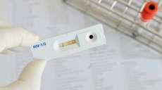 Teste de HIV passar&aacute; a ser vendido em farm&aacute;cias; entenda como vai funcionar