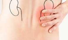 Pedra nos rins: saiba como prevenir esse temido problema