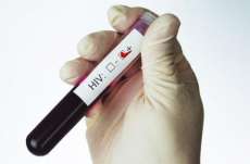 No Pa&iacute;s, 20% dos infectados n&atilde;o sabem que t&ecirc;m AIDS