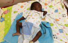 Beb&ecirc; nasce com 4 pernas e 4 bra&ccedil;os em Uganda, na &Aacute;frica