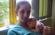 Menina nasce com l&iacute;ngua que nunca para de crescer e recorre &agrave; cirurgias para ter vida normal