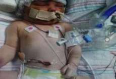 Pais choram morte de beb&ecirc; que teve coluna quebrada no parto