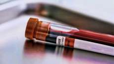 Novo exame de sangue pode detectar problemas card&iacute;acos desconhecidos
