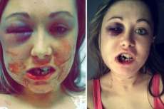 Jovem relata agress&atilde;o ap&oacute;s negar sexo ao ex-companheiro