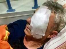 Laranjeiras - PRF baleado perde visão do olho esquerdo