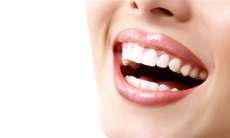 Clareamento dental funciona?