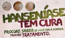 Pinh&atilde;o - Secretaria Municipal de Sa&uacute;de de Pinh&atilde;o Vigil&acirc;ncia Epidemiol&oacute;gica orienta sobre combate &agrave; Hansen&iacute;ase