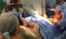 'Ces&aacute;rea natural' &eacute; alternativa para diminuir complica&ccedil;&otilde;es da cirurgia. Asssistam