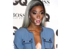 Corredor da F1 est&aacute; namorando modelo famosa por vitiligo