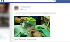 Hospital improvisa pote de pl&aacute;stico para salvar vida de beb&ecirc;