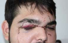 "Calouro n&atilde;o precisa ser humilhado s&oacute; porque &eacute; calouro", diz jovem agredido por recusar trote