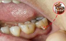 Refrigerantes zero e balas diet detonam seus dentes tanto quanto a&ccedil;&uacute;car. Entenda!
