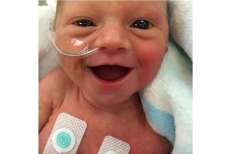 Foto de beb&ecirc; prematuro rindo viraliza na web