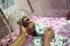 Pais abandonam beb&ecirc; ap&oacute;s crian&ccedil;a nascer com pele enrugada
