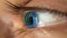 Como evitar que seus olhos fiquem &lsquo;cansados&rsquo; ap&oacute;s um dia inteiro olhando para telas