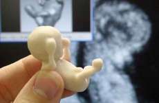 Impress&atilde;o 3D traz o beb&ecirc; do ultrassom &agrave; realidade