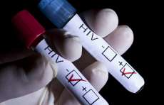 Segundo estudo, no mundo h&aacute; 2,5 milh&otilde;es de novos casos de HIV por ano