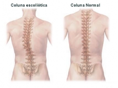 Reeduca&ccedil;&atilde;o Postural Global e Postura