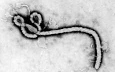 Anvisa garante que chance do v&iacute;rus do ebola chegar ao Brasil &eacute; quase nula