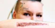 Jovem tra&iacute;da corta tatuagem com nome de namorado e envia peda&ccedil;o da pele para ele por meio dos correios