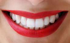 Tire todas suas d&uacute;vidas sobre clareamento dental