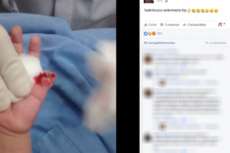 Enfermeira corta dedo de beb&ecirc; em hospital