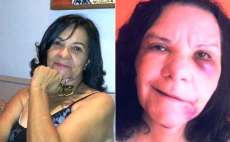 Cirurgia pl&aacute;stica deixa apresentadora de TV com o rosto deformado em Cascavel