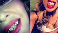 Moda - J&aacute; conhece os &ldquo;grillz&rdquo;? Eles s&atilde;o a mais nova moda entre as celebridades