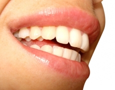 Dentes cariados... voc&ecirc; tem?