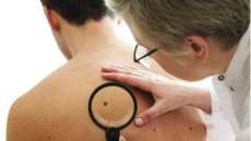 Mais de 11 sinais no bra&ccedil;o indica risco de melanoma. Confira!