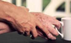 Pesquisa de brasileiro pode reduzir incid&ecirc;ncia de Alzheimer e Parkinson