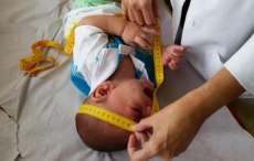 Projeto de lei prev&ecirc; aumento de pena para aborto em caso de microcefalia
