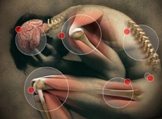 Se voc&ecirc; tem dificuldades para dormir, irritabilidade ou at&eacute; depress&atilde;o, fique atento, pode ser dor Neurop&aacute;tica, a fisioterapia pode ajud&aacute;-lo