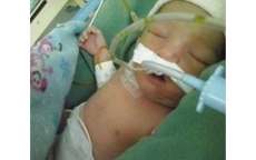 Beb&ecirc; com doen&ccedil;a grave depende de cirurgia de R$ 2 milh&otilde;es para sobreviver